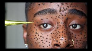 Maybe you would like to learn more about one of these? I Tried Henna Freckles On My Dark Skin Andd Youtube