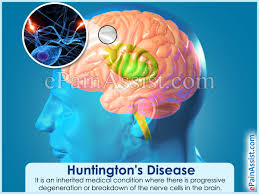 Huntington S Disease Causes Symptoms Treatment Home Remedies
