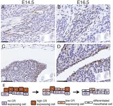 Mesothelial tissue also surrounds the male internal reproductive organs (the tunica vaginalis testis) and covers the internal reproductive organs of women (the tunica. Overexpression Or Absence Of Calretinin In Mouse Primary Mesothelial Cells Inversely Affects Proliferation And Cell Migration Respiratory Research Full Text