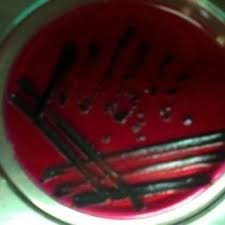 Xylose lysine deoxycholate agar (xld agar) is a selective growth medium used in the isolation of salmonella and shigella species from clinical samples and from food. Salmonella Spp Produces Round Black Center Colony In Xld Agar Media Download Scientific Diagram