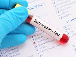 what are normal testosterone levels ages males females