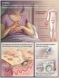 Image result for scabies in the groin area