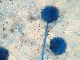 Image result for Phragmanthera capitata