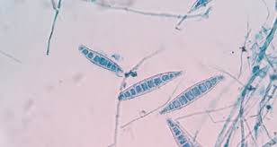 The primary ingredient of many hand sanitizers is ethyl alcohol. Ringworm In Rabbits And Guinea Pigs Transmission Signs Diagnosis Treatment Petcoach
