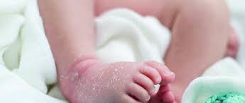 If your doctor has prescribed any topical medicines, apply these to the areas of rash (before applying any moisturizers). Treating Dry Skin Conditions In Children And Babies Nursing In Practice