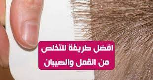 كيف اتخلص من القمل والصيبان نهائيا وبسرعة القمل من أكثر المشاكل شيوعا عند الأطفال هذه الحشرات الصغيرة تستفيد من رؤوس أطفالنا بالإضافة إلى ذلك هناك مشكلة انه