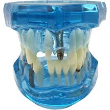 Image result for ochrana chrupu