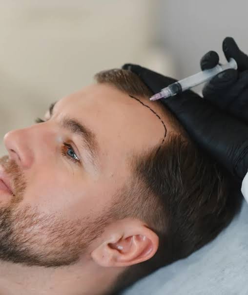 Stem Cell Therapy for Hair in Dubai at Nova Clinic