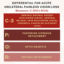 Image result for Acute Vision Loss