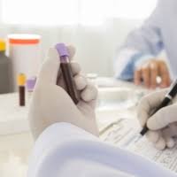 This limits the potential for tumor marker tests to help in diagnosing cancer. Tumour Markers Cea Ca125 And Ca19 9 What Are They And What Do They Mean Pseudomyxoma Survivor