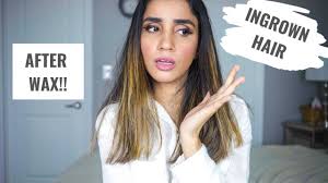 The most common cause of ingrown hairs is dead skin cells on the surface of the skin. How To Really Prevent Ingrown Hair After Waxing Youtube