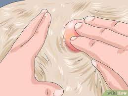 If your dog has developed a lump or mass, you should take him to the vet, who will likely perform a biopsy. How To Know If Your Dog Has Cancer 11 Steps With Pictures