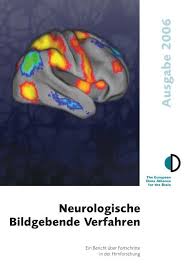 Villarreal page) and competitions pages (champions league, premier. Neurologische Bildgebende Verfahren Dana Foundation