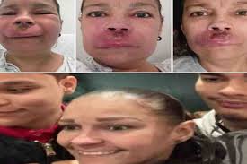 Fundraiser by Adriel Guzman : Urgent Aid for Juliana's Medical and Living  Expenses