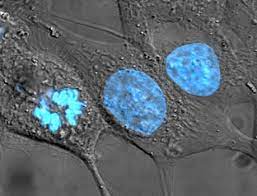 Size of vacuole is small when compared to plant cell vacuole.in animal cells centriols are present.membrane bound cell organells are present since it is an eukaryotic cell.nucleus is present. Cell Nucleus Wikipedia