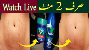 Apply Vicks Vaporub To Remove Stretch Marks In 2 Minutes 100 Effective Youtube