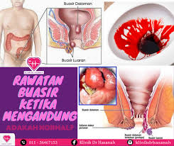 Posted by kisah cerita dewasa on rabu, 05 februari 2014 2. ð'ºð'¬ð'¹ð'¨ð'´ ð'µð'² ð'´ð'¨ð'ºð'¼ð'² ð'»ð'¶ð'°ð'³ð'¬ð'» ð'²ð'¨ð'³ð'¨ð'¼ ð'¨ð'«ð'¨ Klinik Dr Hasanah Facebook