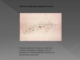 Calcium Carbonate Crystal Calcium Carbonate Crystals Carbonate