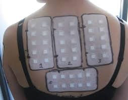 Image result for Patch Testing