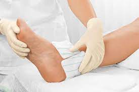 Ulcerul varicos, denumit si ulcer venos de gamba, este cel mai frecvent tip de ulcer de piele. Ulcerul De Gamba I Medic Ro