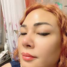 SALT LAKE CITY BOTOX AND FILLERS