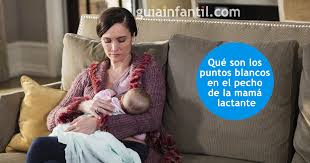 Que Significan Los Puntos Blancos En El Pecho De La Mama Lactante