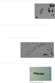 Grátis: URINÁLISE - EXAME MICROSCÓPICO - Material Claro e Objetivo em PDF  para Estudo Rápido
