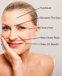 Before any treatment you will have a comprehensive initial consultation and we also offer a free follow up appointment 2 weeks later. How Much Does Botox Cost Our Price Estimating Guide For Common Areas Treated By Botox Altura Aesthetics Botox Cost Botox Forehead Botox Lips