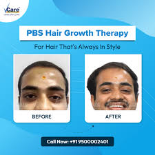 Tired of hiding your thinning hair? Look at the difference PBS made Before:  Thin, fragile hair that just wouldn't grow After: Fuller, stronger, and  healthier hair that brings back confidence PBS Hair