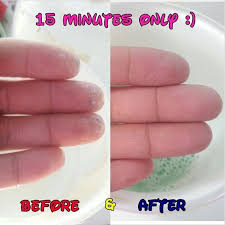 How To Get Super Glue Off Skin How To Remove Glue Super Glue Remove Super Glue