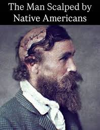 In 1864, at just 14 years old, Robert McGee was brutally scalped. He had  been working as a teamster for H.C. Barret, helping to transport a flour  caravan to Fort Union in