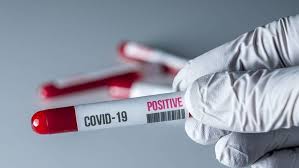 What is rapid diagnostic test (rdt)? Dh50 Covid 19 Rapid Test To Enter Abu Dhabi Gives Results In Minutes News Khaleej Times