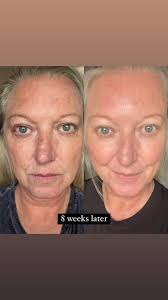 Let me tell you a little bit about RIman skincare: RIMAN has : 🔵 has 15  patented ingredients 🔵￼ patented rights to incredible technology 🔵￼  Exosomes 🔵 Niacinamides 🔵￼ clean vegan