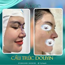 THẨM MỸ VIỆN AONE