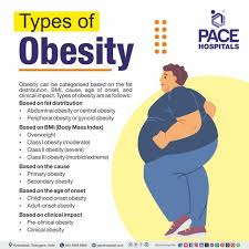 Image result for Obesity