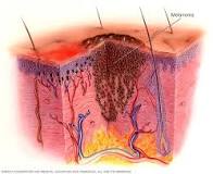 Image result