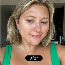 Dr. Dennis Gross LED Mask Review: Does it Work and Benefits 2024