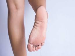 Squamous cell carcinoma is the most common form of cancer on the skin of the feet. What Your Feet Say About Your Health The Times Of India
