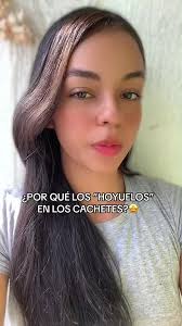 Gracias por existir personas con hoyuelos 😜❤️ . . . Mándale a esa persona  que se ve espectacular cuando sonrie por sus hoyuelos en los cachetes. . .  Para más contenido asi siguenos en instagram como ...