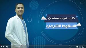 السقوط الشرجي أسبابه و طرق علاجه مع الدكتور #محمد_بلاطة - YouTube