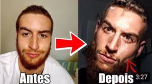 Try the below exercises to get high cheek bones. Hollow Cheeks How They Can Be Formed By Mewing Tooth For A Tooth Com