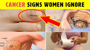 Cancer signs and symptoms in women the most common type of lung cancer in women is adenocarcinoma, and these carcinomas tend to grow on the outer parts of the lungs (2). 12 Signs Of Cancer Mostly Ignored By Women Youtube