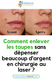 Pin On Astuces Beaute