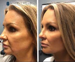 Beverly Hills Rejuvenation Center® Featured