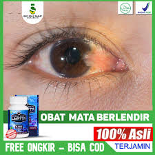 Check spelling or type a new query. Obat Herbal Mata Berlendir Mata Merah Gatal Berair Penglihatan Buram Sehat Mata Softgel Asli Shopee Indonesia
