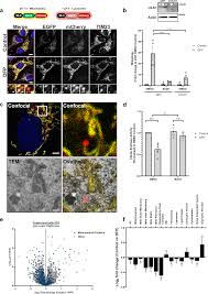 Not everyone can say they ti. Gak And Prkcd Are Positive Regulators Of Prkn Independent Mitophagy Nature Communications