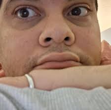 Is a Hickory Tussock Moth good or bad to have around?