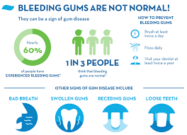 Bleeding Gums: Causes, Treatments, And Prevention - Crest