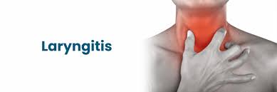 Image result for Acute Laryngitis