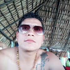 KENIA PARECE CHISTE... PERO NO ES En Kenia, un hospital le dijo a un  paciente que tenía una cucaracha viva en el pecho tras una radiografía y lo  enviaron a Singapur. Allí